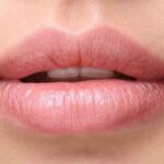 lip pigmentation