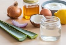 A photo of a table with various ingredients. There's a jar of aloe vera gel, a jar of coconut oil, a jar of honey, a sliced onion, a whole egg, a bowl of yogurt, and a lemon. The aloe vera gel, coconut oil, honey, and lemon are placed in a row. The sliced onion, whole egg, and bowl of yogurt are placed in another row. The aloe vera gel has a small amount of liquid inside. The background is light.